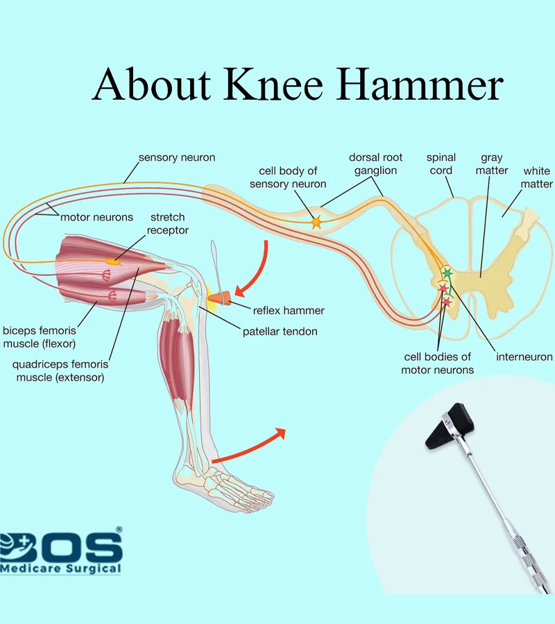 knee hammer