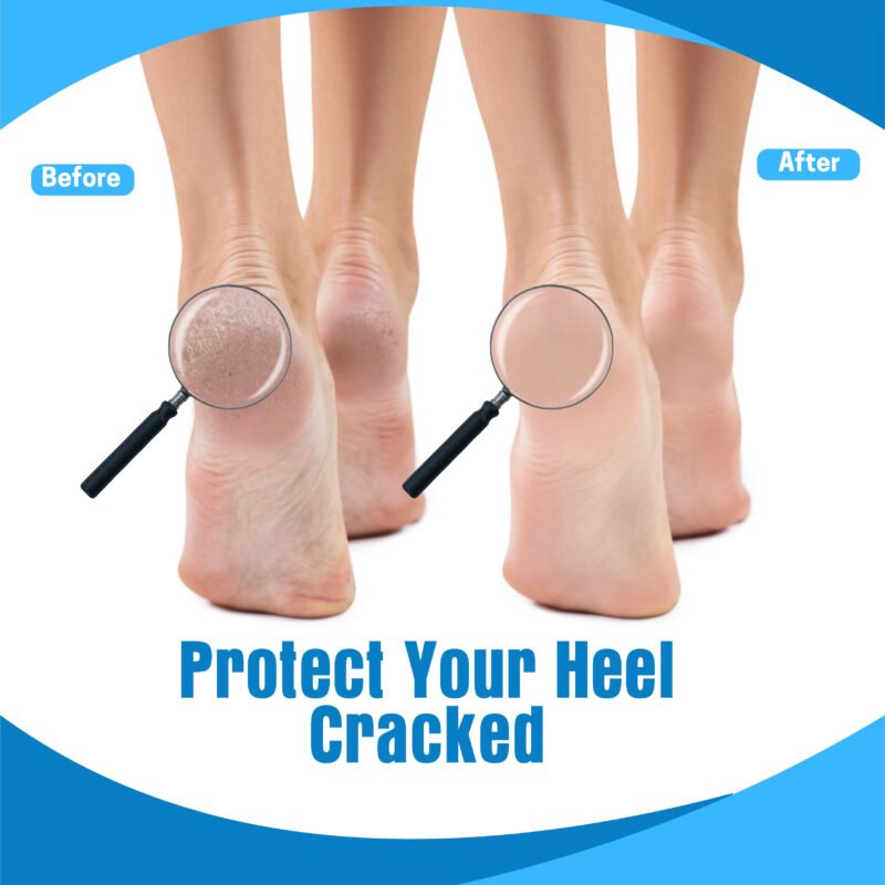Silicone Heel Cups for Cracked Heel Protection and Heel Pain Relief