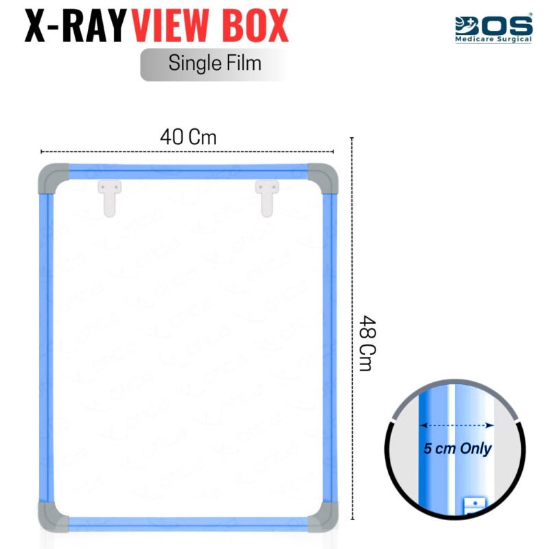 LED X ray view box medical film viewer diagnostic equipment