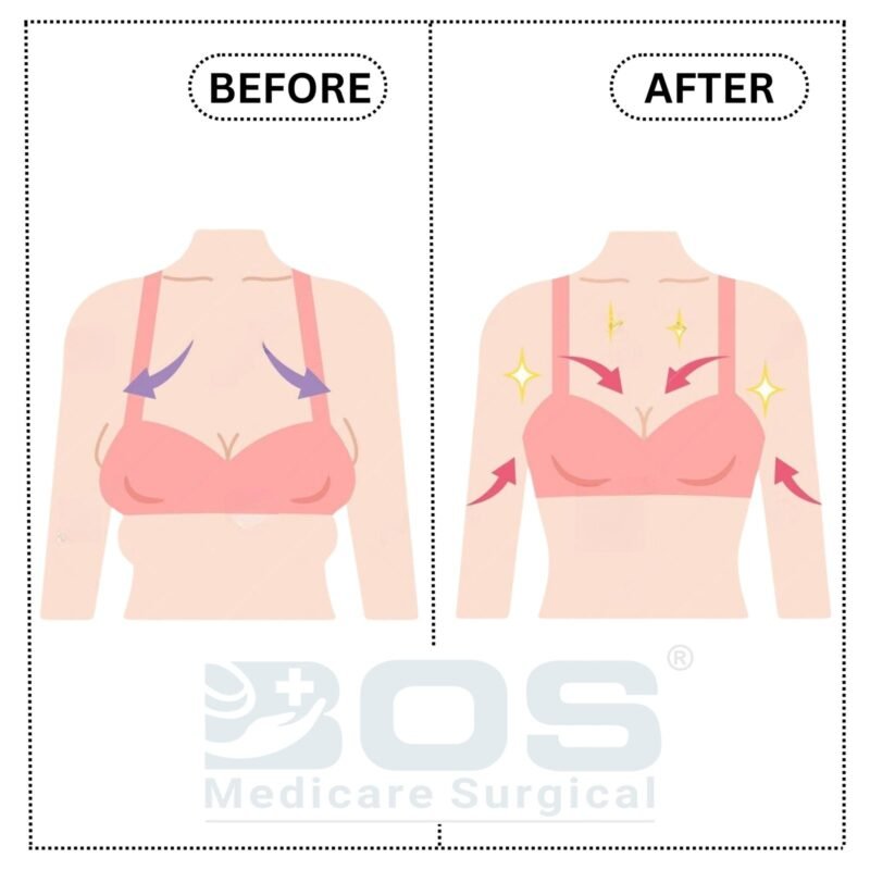 Breast Vacuum Cup Pump Before and After Illustration