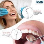 Dental Probe
