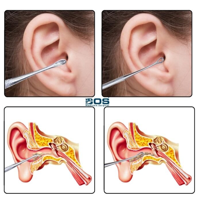 Ear Curette Earwax Removal