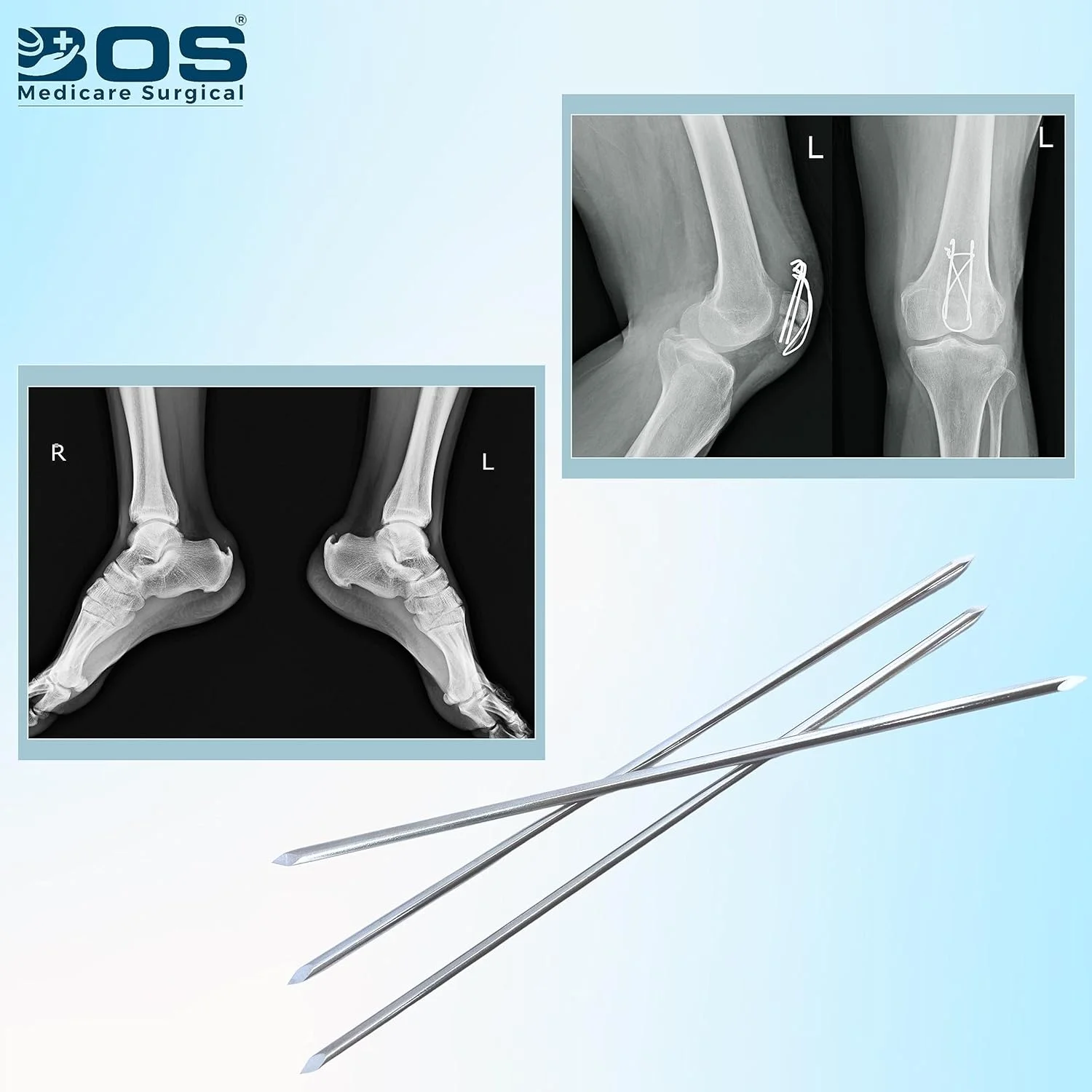 Orthopedic K Wire Stainless Steel