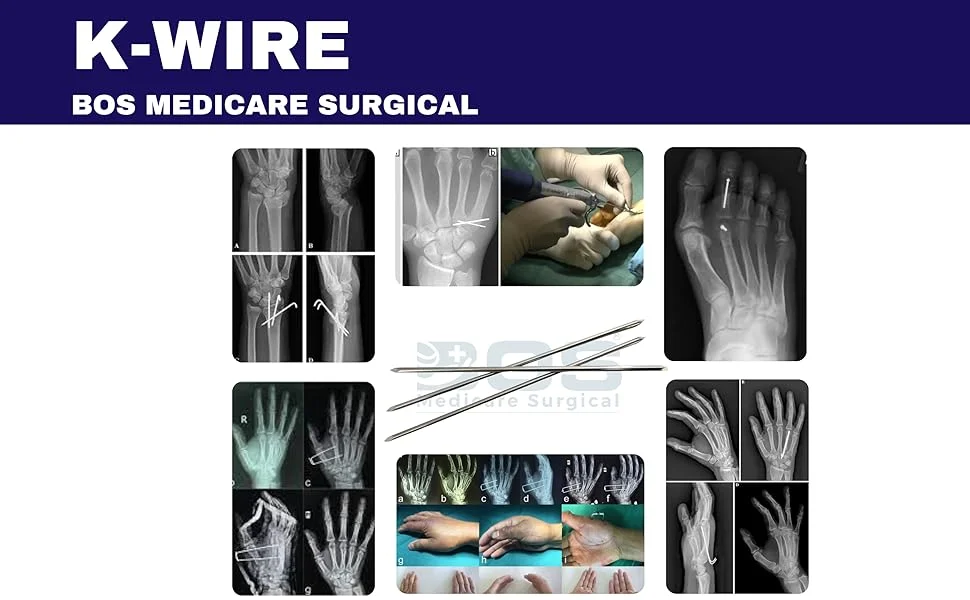 Orthopedic K Wire Stainless Steel Double Ended Pack of 20 for Bone Fixation Surgery