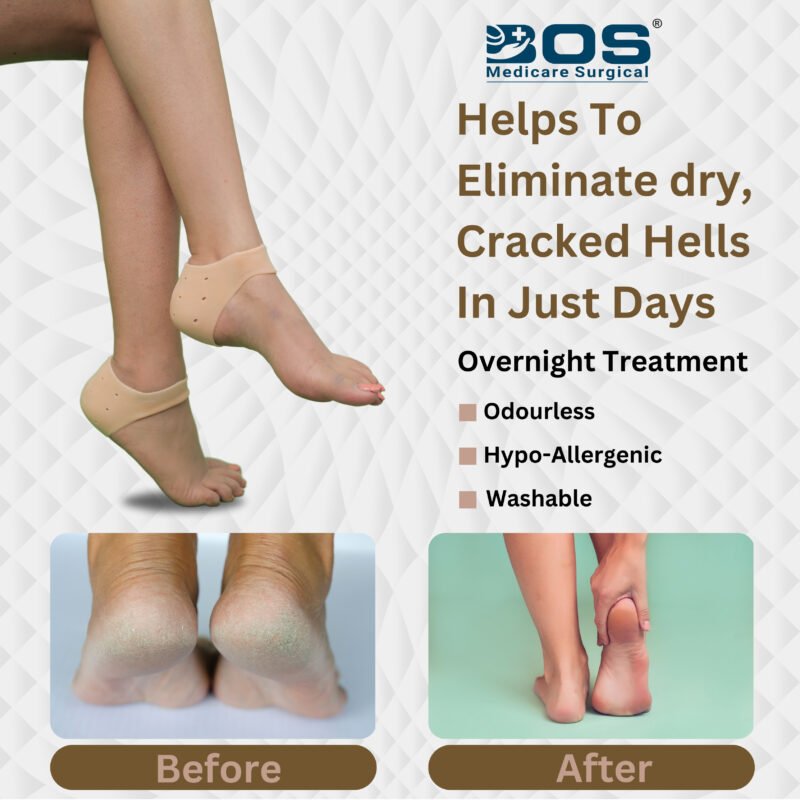 Silicone Heel Gel for Hard Dry and Cracked Heel Repair