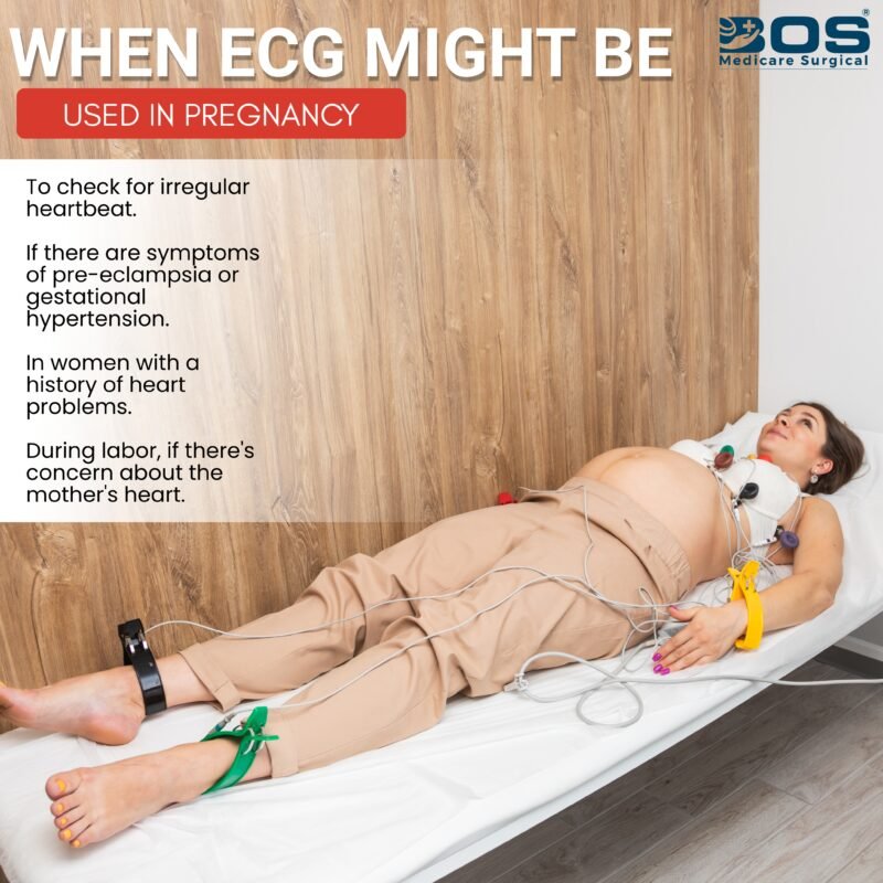 ECG Clamp Limb Electrode Set