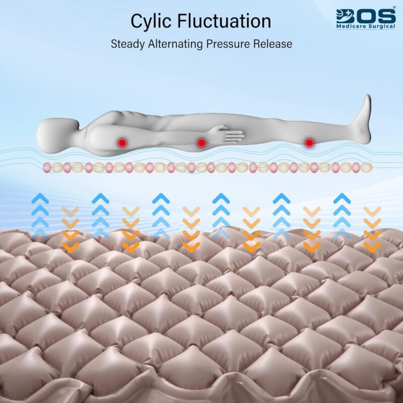 Cyclic Alternating Pressure Air Mattress Technology